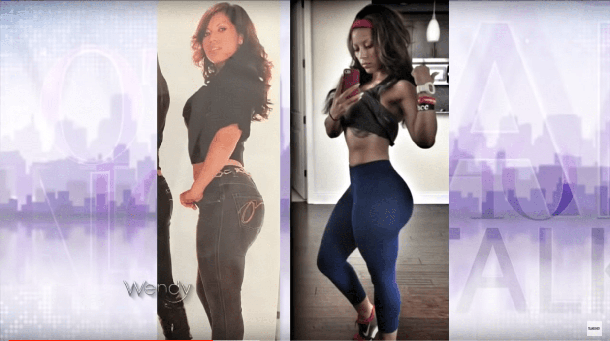 Fitness Instagrammer Sues Miami Plastic Surgeon for Botched Butt-Injection Removal